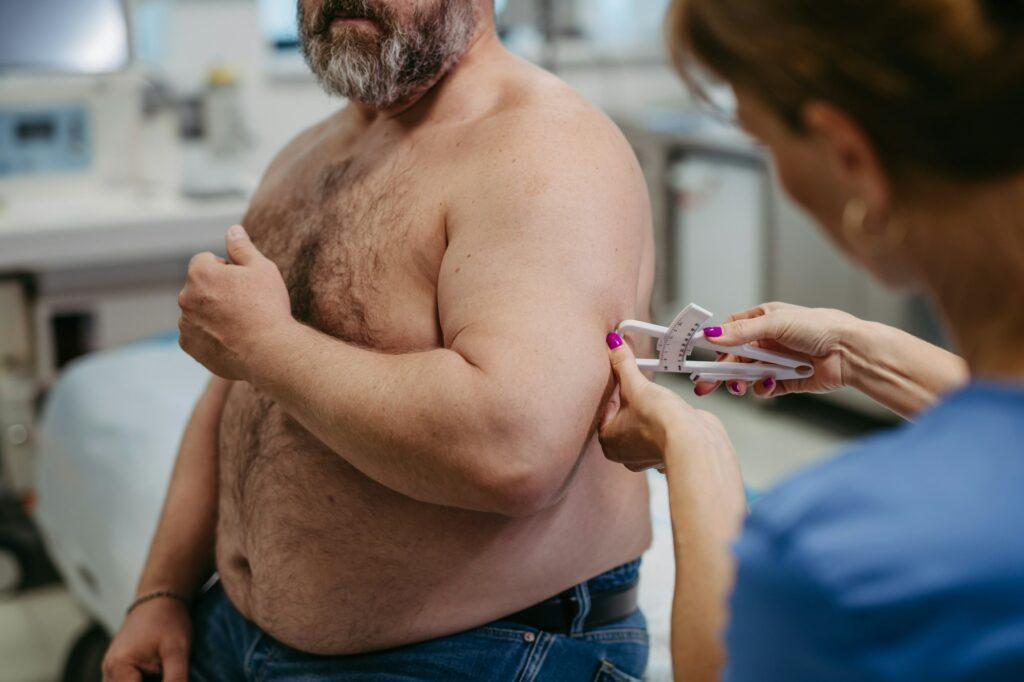 Female doctor measuring body fat of overweight patient using a caliper. Obesity affecting middle