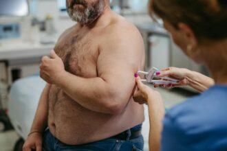 Female doctor measuring body fat of overweight patient using a caliper. Obesity affecting middle