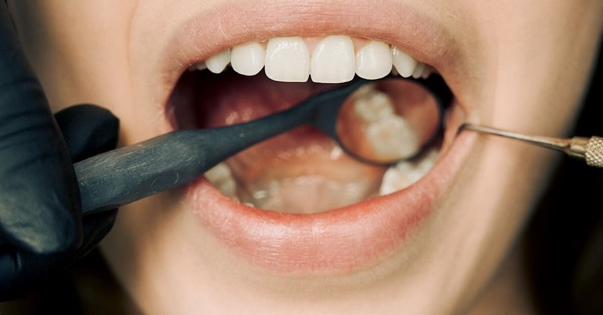 découvrez des remèdes efficaces pour lutter contre la perte de dents et préserver votre santé bucco-dentaire. apprenez des solutions naturelles et des conseils pratiques pour renforcer vos dents et prévenir leur perte.