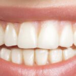 découvrez des solutions efficaces pour remédier à la perte de dents. apprenez des techniques naturelles et des traitements modernes pour restaurer votre sourire et maintenir une bonne santé bucco-dentaire.