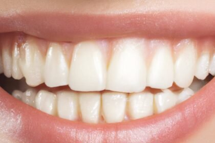 découvrez des solutions efficaces pour remédier à la perte de dents. apprenez des techniques naturelles et des traitements modernes pour restaurer votre sourire et maintenir une bonne santé bucco-dentaire.