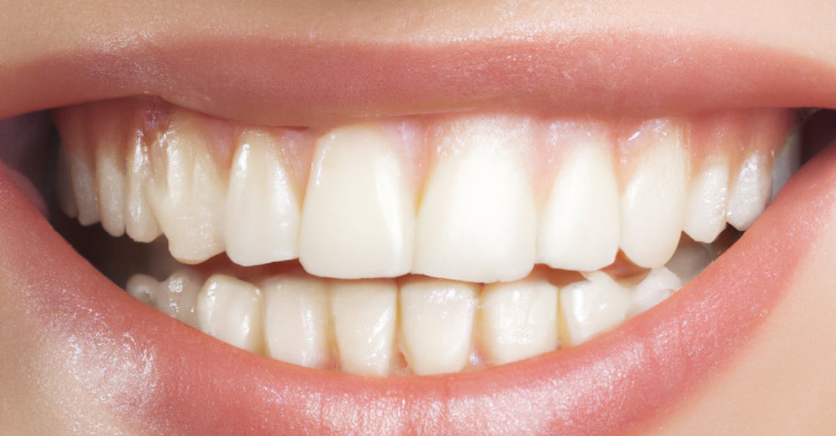 découvrez des solutions efficaces pour remédier à la perte de dents. apprenez des techniques naturelles et des traitements modernes pour restaurer votre sourire et maintenir une bonne santé bucco-dentaire.
